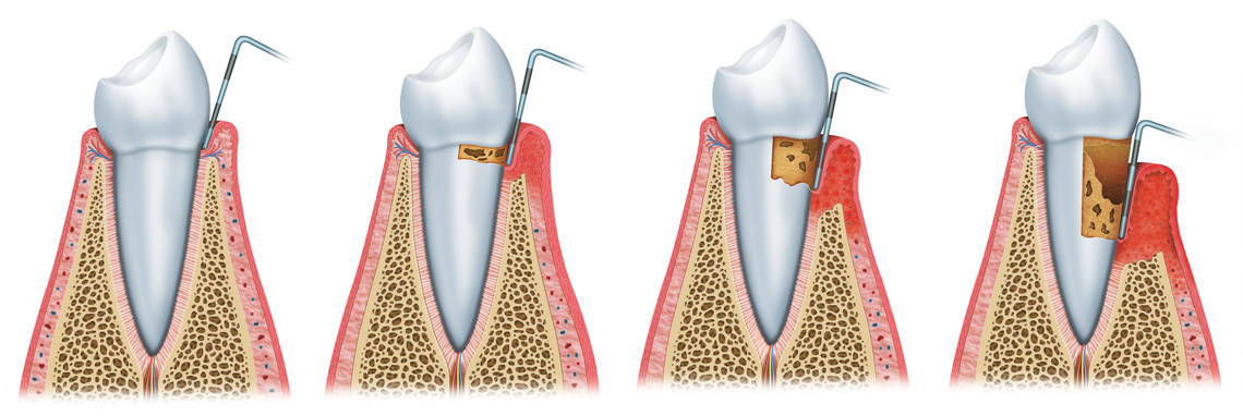 Periodontologia